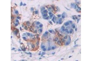 IHC-P analysis of Human Tissue, with DAB staining. (SMPD2 抗体  (AA 2-236))