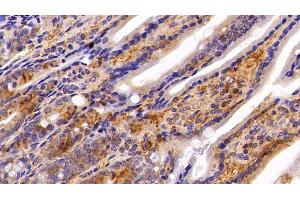 Immunohistochemistry (IHC) image for anti-Nucleoside diphosphate kinase B (NME2) (AA 8-149) antibody (ABIN7439627)