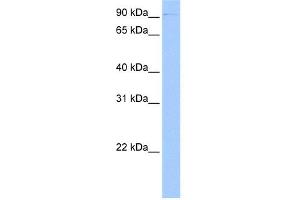 WB Suggested Anti-CTBP2 Antibody Titration:  0. (CTBP2 抗体  (C-Term))