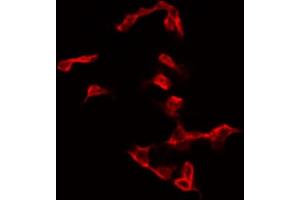 ABIN6267376 staining NIH-3T3 by IF/ICC. (Glycogen Synthase 1 抗体  (pSer645))