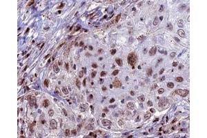 ABIN6266946 at 1/100 staining human lung tissue sections by IHC-P. (CDKL4 抗体  (Internal Region))