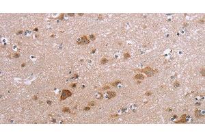 Immunohistochemistry of paraffin-embedded Human brain using PPP2R3C Polyclonal Antibody at dilution of 1:30 (PPP2R3C 抗体)