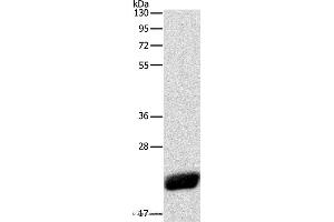 Western blot analysis of Human leiomyosarcoma tissue, using CAV1 Polyclonal Antibody at dilution of 1:525 (Caveolin-1 抗体)