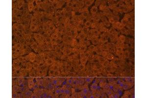 Immunofluorescence analysis of Rat liver using UGT1A1 Polyclonal Antibody at dilution of 1:100. (UGT1A1 抗体)