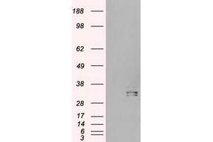 HEK293T cells were transfected with the pCMV6-ENTRY control (Left lane) or pCMV6-ENTRY HHex (RC204815) (Right lane) cDNA for 48 hrs and lysed. (HHEX 抗体  (AA 100-270))
