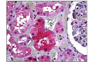 Immunohistochemistry (IHC) image for anti-Galactose-1-Phosphate Uridylyltransferase (GALT) antibody (ABIN781864) (GALT 抗体)