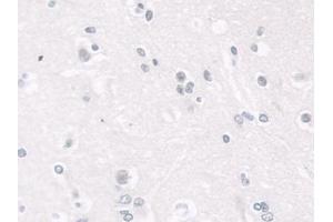 Detection of LMNB1 in Human Cerebrum Tissue using Polyclonal Antibody to Lamin B1 (LMNB1) (Lamin B1 抗体  (AA 52-233))