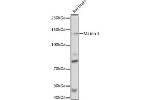 Western blot analysis of extracts of Rat brain, using Matrin 3 Rabbit mAb (ABIN7268414) at 1:1000 dilution. (MATR3 抗体)