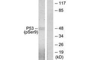 Western blot analysis of extracts from LOVO cells, using p53 (Phospho-Ser9) Antibody. (p53 抗体  (pSer9))