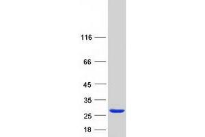 Glucosamine-Phosphate N-Acetyltransferase 1 (GNPNAT1) protein (Myc-DYKDDDDK Tag)