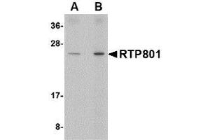 Image no. 1 for anti-DNA-Damage-Inducible Transcript 4 (DDIT4) (Internal Region) antibody (ABIN1493798) (DDIT4 抗体  (Internal Region))