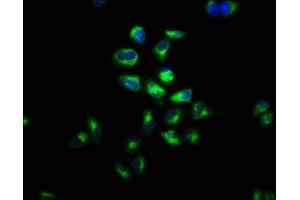 Immunofluorescence staining of Hela cells with ABIN7158126 at 1:100, counter-stained with DAPI. (LGR4 抗体  (AA 234-365))