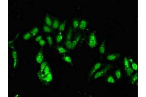 Immunofluorescent analysis of Hela cells using ABIN7147793 at dilution of 1:100 and Alexa Fluor 488-congugated AffiniPure Goat Anti-Rabbit IgG(H+L) (CLOCK 抗体  (AA 577-846))