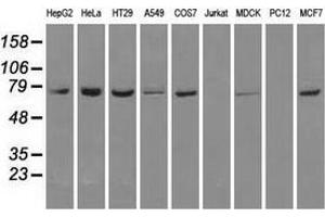Western blot analysis of extracts (35 µg) from 9 different cell lines by using anti-HSPA1A monoclonal antibody. (HSP70 1A 抗体)