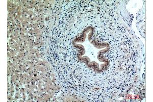 Immunohistochemistry (IHC) image for anti-Protein Phosphatase 1, Regulatory Subunit 15B (PPP1R15B) (Internal Region) antibody (ABIN6283971)