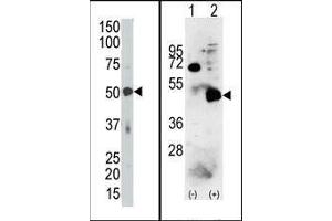 (LEFT) The PDK4 Antibody (C-term) is used in Western blot to detect PDK4 in mouse skeletal muscle tissue lysate. (PDK4 抗体  (C-Term))