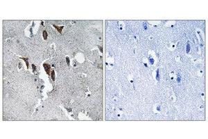Immunohistochemistry (IHC) image for anti-ELOVL Fatty Acid Elongase 5 (ELOVL5) (C-Term) antibody (ABIN1851297) (ELOVL5 抗体  (C-Term))