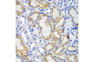 Immunohistochemistry of paraffin-embedded mouse kidney using HCLS1 antibody (ABIN3023093, ABIN3023094, ABIN3023095 and ABIN6219386) at dilution of 1:100 (40x lens). (HCLS1 抗体  (AA 1-280))