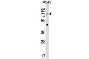 Western Blotting (WB) image for anti-Acyl-CoA Synthetase Medium-Chain Family Member 2A (ACSM2A) antibody (ABIN3000465) (ACSM2A 抗体)