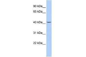 WB Suggested Anti-SEPT2 Antibody Titration: 0. (Septin 2 抗体  (Middle Region))