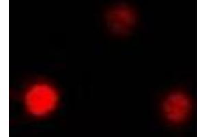 Immunofluorescent analysis of QKI staining in MCF7 cells. (QKI 抗体)