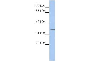 WB Suggested Anti-PITX1 Antibody Titration:  0.