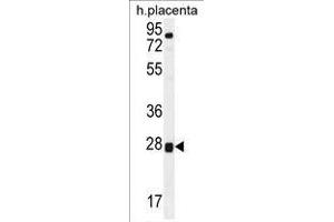 TOR2A Antibody (Center) western blot analysis in human placenta tissue lysates (35 µg/lane). (TOR2A 抗体  (Middle Region))