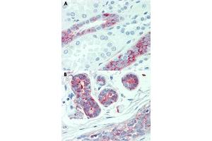 Immunohistochemical staining of human kidney (A) and human breast (B) with SLC4A2 polyclonal antibody . (SLC4A2 抗体  (Internal Region))