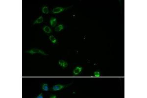 Immunofluorescence analysis of MCF-7 cells using HFE Polyclonal Antibody (HFE 抗体)