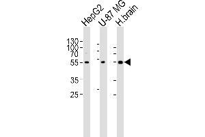 Western blot analysis of lysates from HepG2, U-87 MG cell line and human brain tissue lysate(from left to right), using RGS20 Antibody (Center) (ABIN6243829 and ABIN6577411). (RGS20 抗体  (AA 150-184))