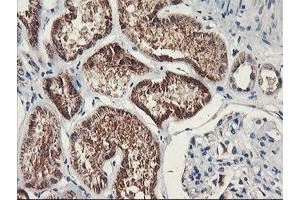 Immunohistochemistry (IHC) image for anti-Prenyl (Decaprenyl) Diphosphate Synthase, Subunit 2 (PDSS2) antibody (ABIN1500138) (PDSS2 抗体)
