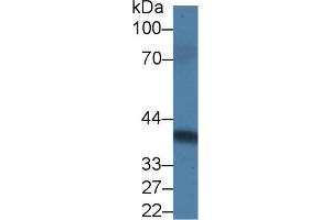 Detection of PRLR in Rat Serum using Polyclonal Antibody to Prolactin Receptor (PRLR) (Prolactin Receptor 抗体  (AA 20-229))