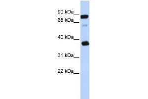 WB Suggested Anti-BCAP29 Antibody Titration:  0. (BCAP29 抗体  (Middle Region))