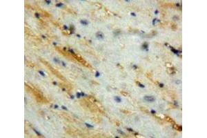 Used in DAB staining on fromalin fixed paraffin-embedded Heart tissue (Corin 抗体  (AA 448-579))