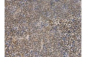 ABIN6255947 and ABIN6274057 at 1/100 staining human normal tonsil tissue by IHC-P.