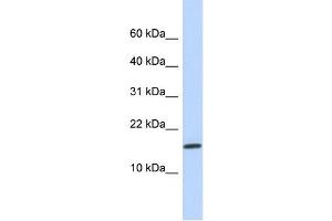 WB Suggested Anti-NCRNA00114 Antibody Titration:  0. (NCRNA00114 抗体  (N-Term))