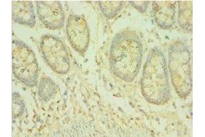 Immunohistochemistry of paraffin-embedded human colon tissue using ABIN7145070 at dilution of 1:100 (COQ8A 抗体  (AA 1-220))