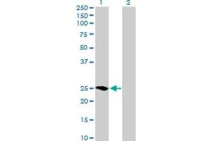 Western Blot analysis of MRAS expression in transfected 293T cell line by MRAS MaxPab polyclonal antibody. (MRAS 抗体  (AA 1-208))