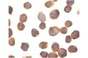 Immunocytochemistry of ZIP kinase in Jurkat cells with this product at 10 μg/ml. (DAPK3 抗体  (Center))