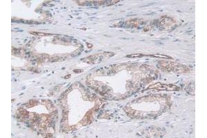 IHC-P analysis of Human Prostate Gland Tissue, with DAB staining. (Pepsin 抗体)