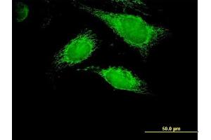 Immunofluorescence of purified MaxPab antibody to PPA2 on HeLa cell. (PPA2 抗体  (AA 1-334))