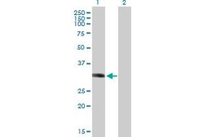 Western Blot analysis of LYSMD2 expression in transfected 293T cell line by LYSMD2 MaxPab polyclonal antibody. (LYSMD2 抗体  (AA 1-215))