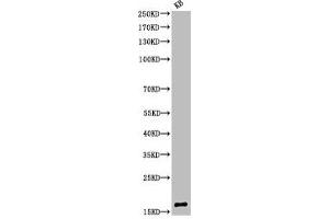 Western Blot analysis of KB cells using Acetyl-Histone H3 (K9) Polyclonal Antibody (HIST1H3A/HIST2H3A/H3F3A (acLys9) 抗体)