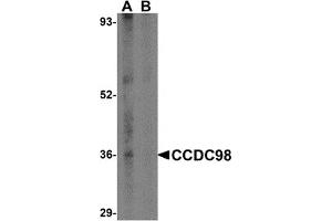Western Blotting (WB) image for anti-Family with Sequence Similarity 175, Member A (FAM175A) (N-Term) antibody (ABIN1031306) (CCDC98 抗体  (N-Term))