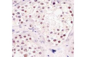 Immunohistochemistry (IHC) image for anti-TATA Box Binding Protein (TBP) antibody (ABIN3029100)
