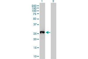 Western Blot analysis of LXN expression in transfected 293T cell line by LXN monoclonal antibody (M01), clone 8H5. (Latexin 抗体  (AA 151-222))