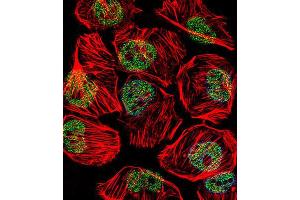Immunofluorescence (IF) image for anti-TATA Box Binding Protein (TBP) antibody (ABIN3002745)