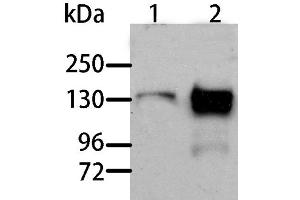 Western Blot analysis of Human liver cancer and normal liver tissue using AOX1 Polyclonal Antibody at dilution of 1:1000 (AOX1 抗体)