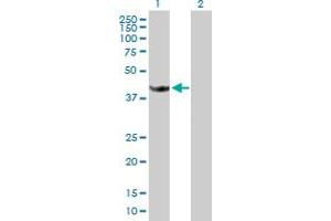 Western Blot analysis of STOML1 expression in transfected 293T cell line by STOML1 MaxPab polyclonal antibody. (STOML1 抗体  (AA 1-398))