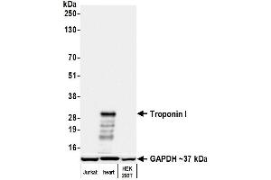 Western Blotting (WB) image for anti-Troponin I (TNNI) (AA 1-50) antibody (ABIN7795679)